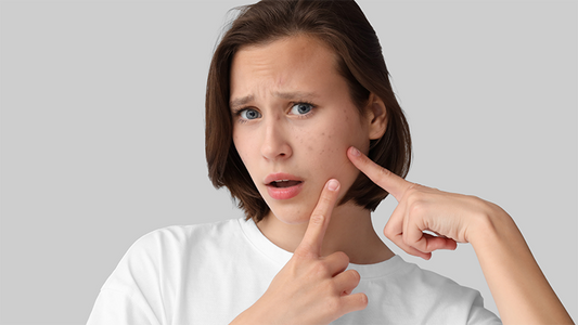 Geniş Gözenekleri Küçültmenin 7 Yolu